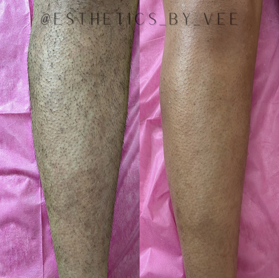 Full Leg