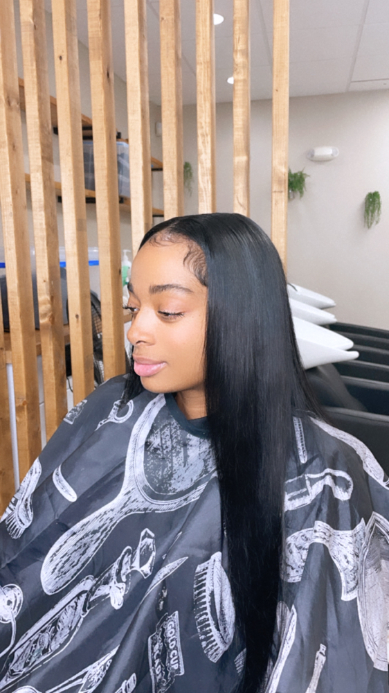 Frontal Install