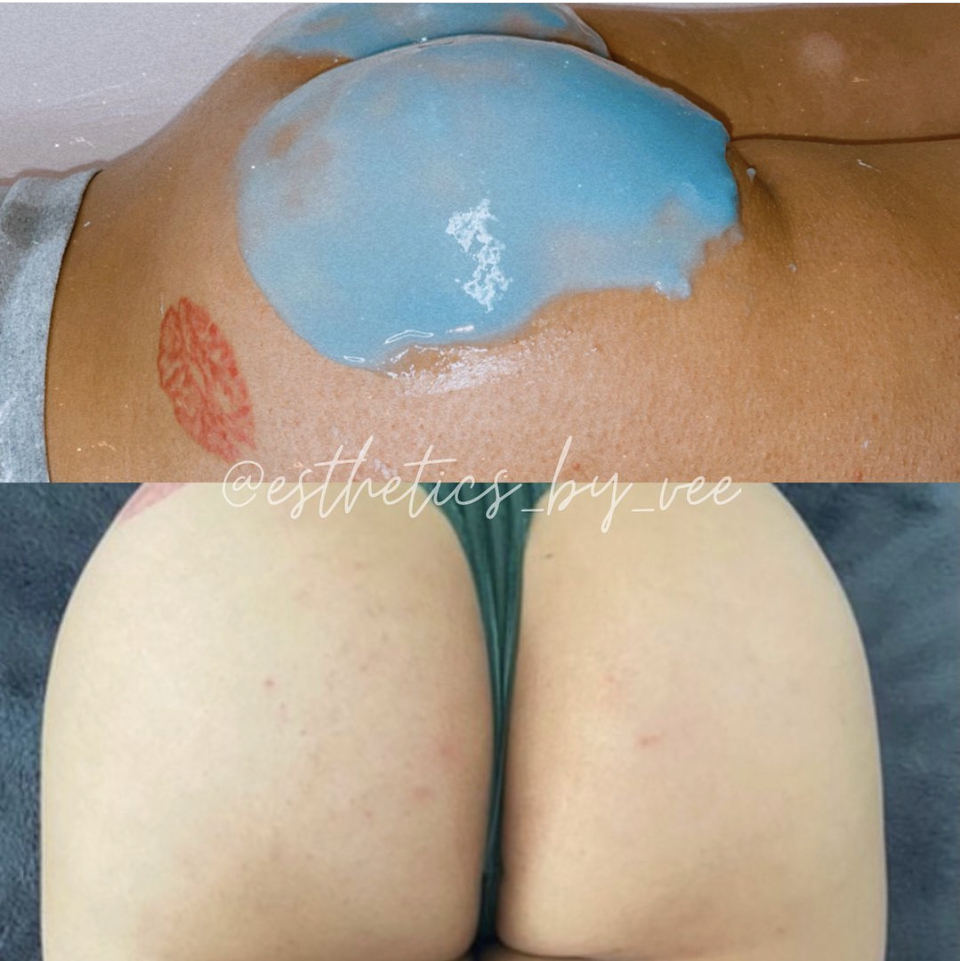 Booty Facial