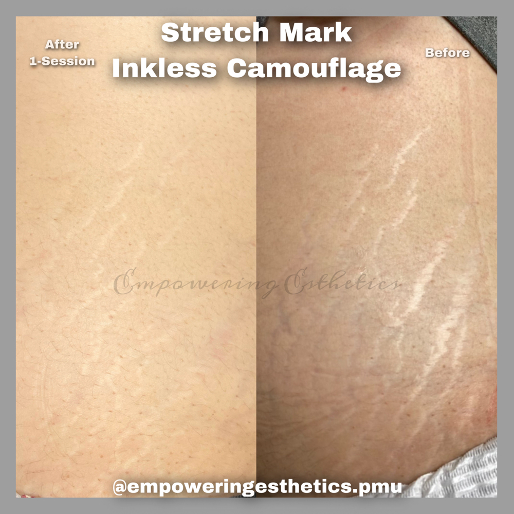 Inkless Stretch Mark Camoflauge