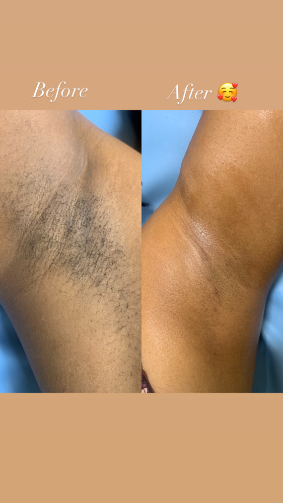 Underarm Wax