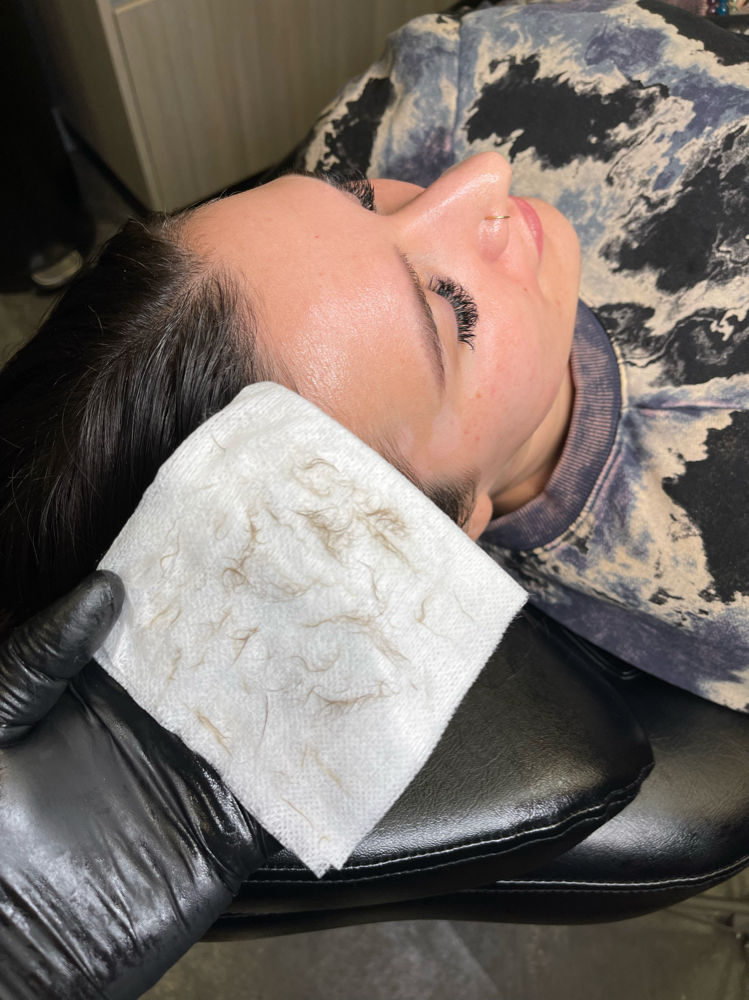 Dermaplaning Facial