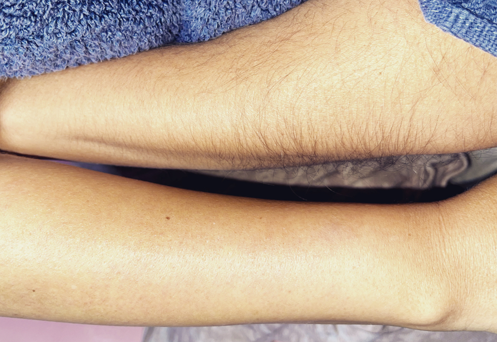 Full Arms