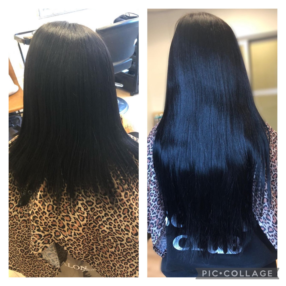 Tape Extension Removal