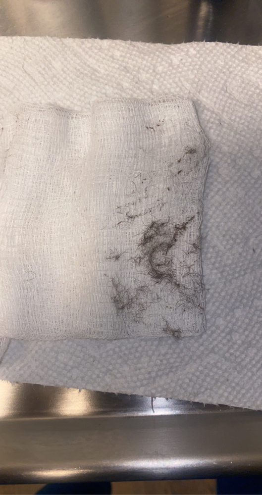 DERMAPLANING