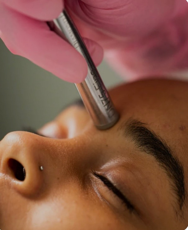 Microdermabrasion Facial