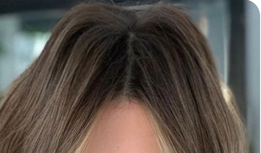 Root Shadow