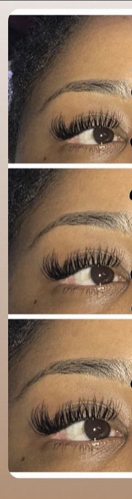 Eyelash Removal