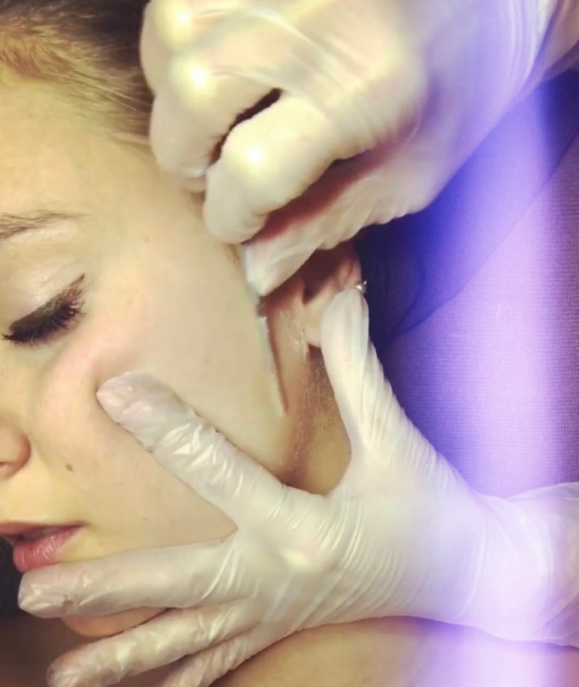 Dermaplaning Facial Add-On