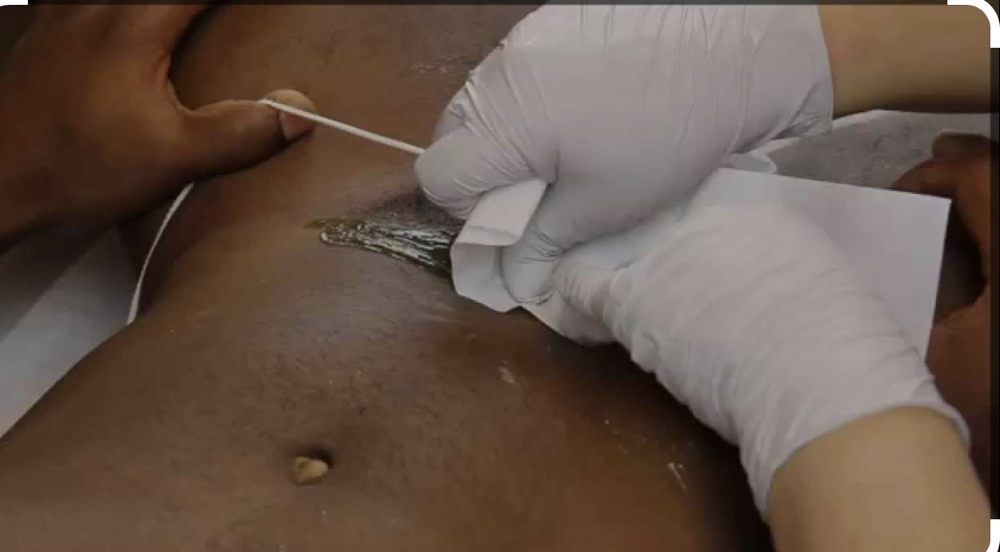 Male Bikini Line Waxing