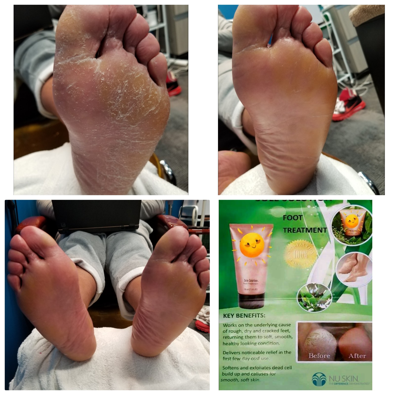 Problematic Feet