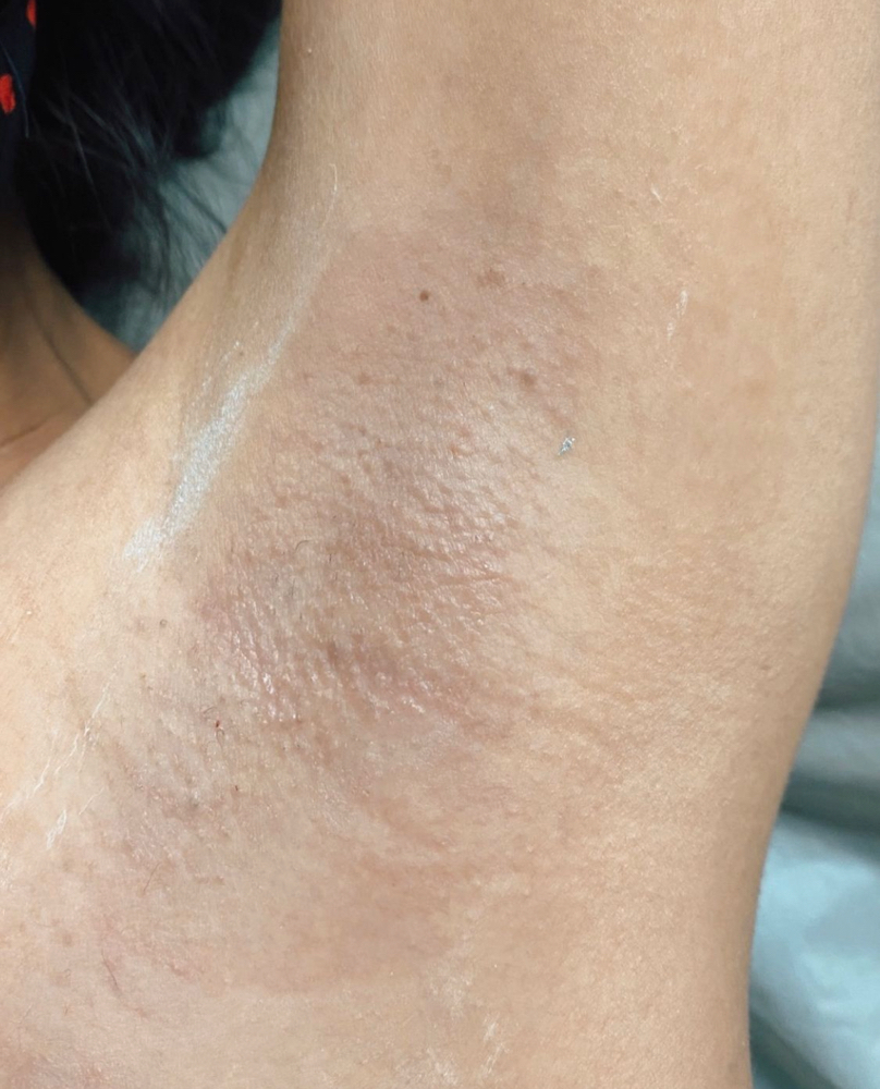 Underarm Wax