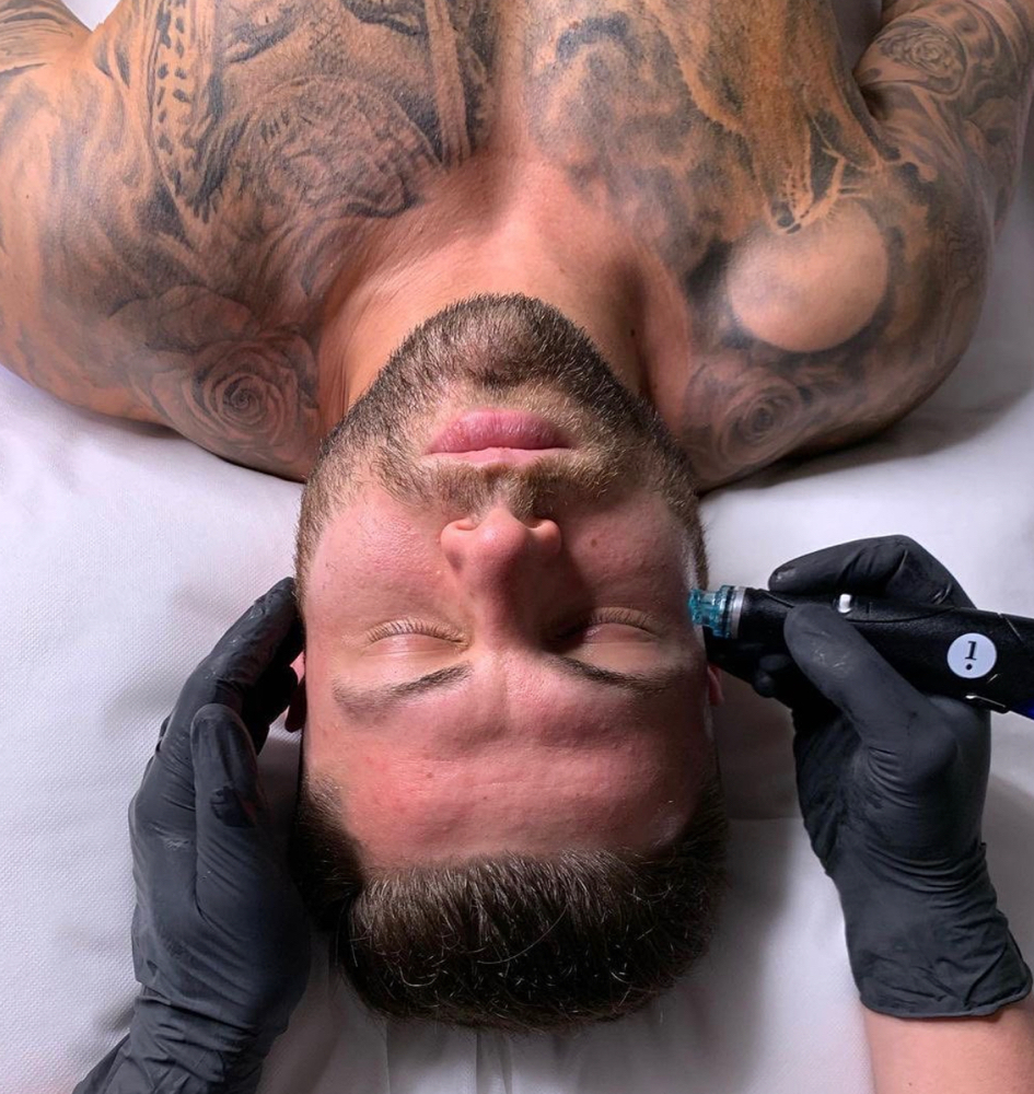 Deluxe Hydrafacial