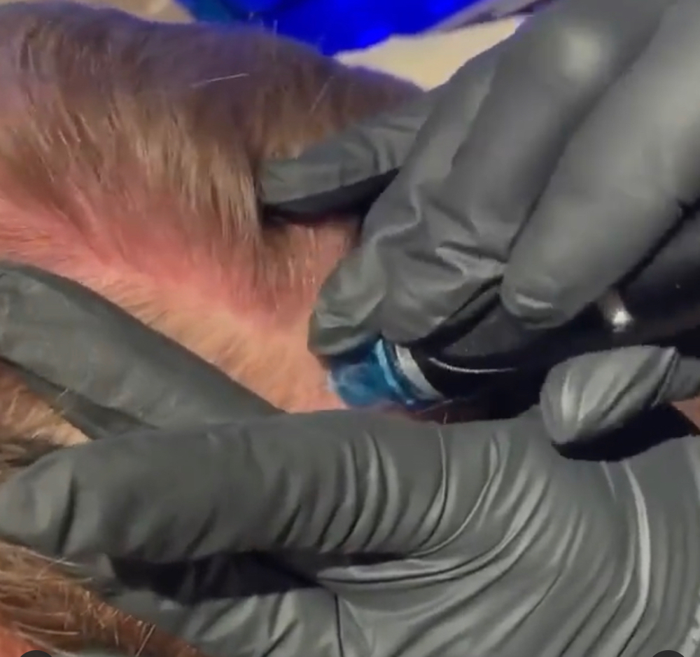 Hydrafacial Keravive (Scalp)