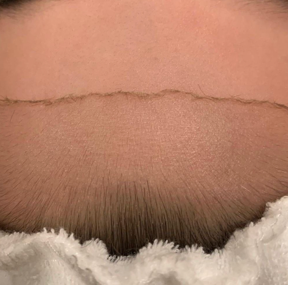 Dermaplane Facial