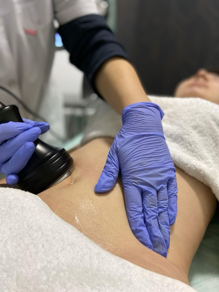 Cavitation Treatment