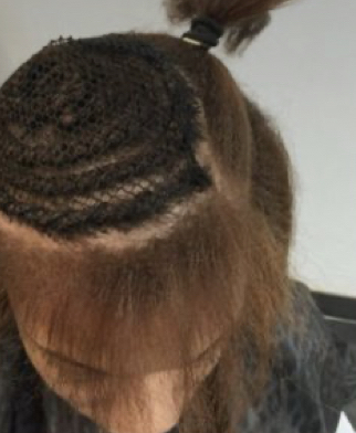 Partial Sew-in