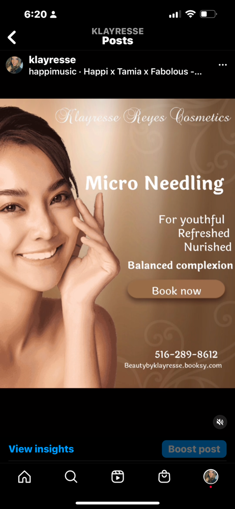 Micro Needling Facial