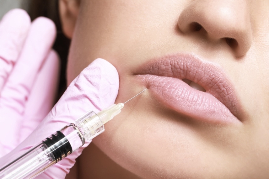 Dermal Fillers