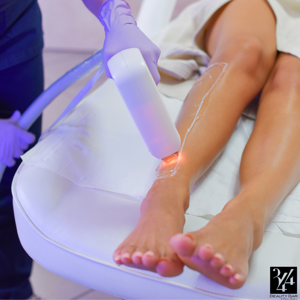 LASER HAIR REMOVAL