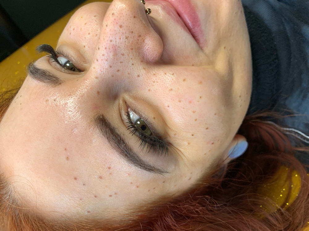 Freckle Touch Up