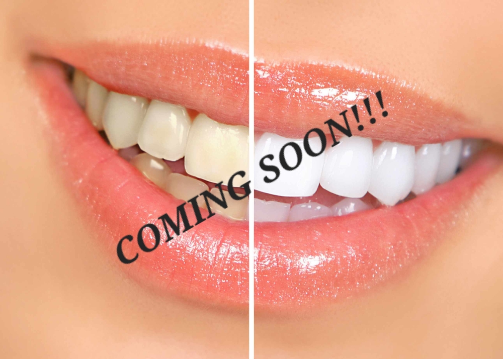 Teeth Whitening