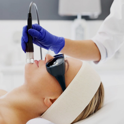 9- Acne Laser Facial