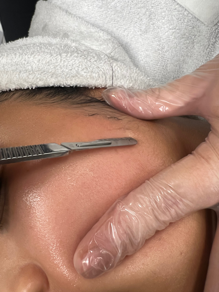 Dermaplanning Treatment at Desert Bloom Skin Studios in North Ogden, UT