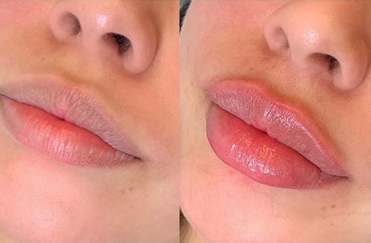 Lip PLUMPS