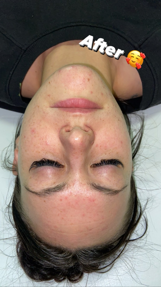 Facial S4S