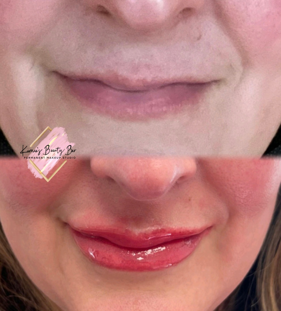 Lip Touchup (w/ in 3 months)