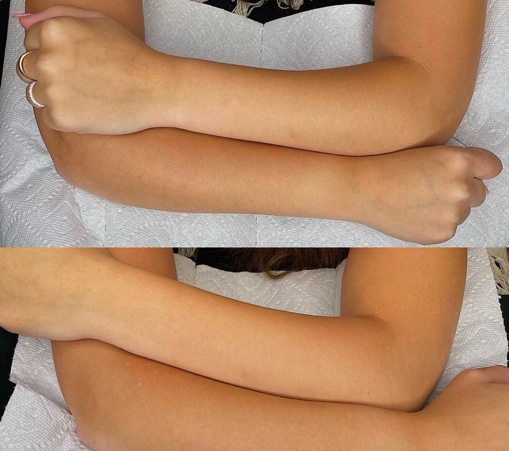 Full Arm Wax