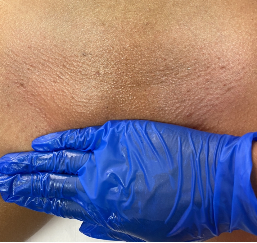 BRAZILIAN WAX
