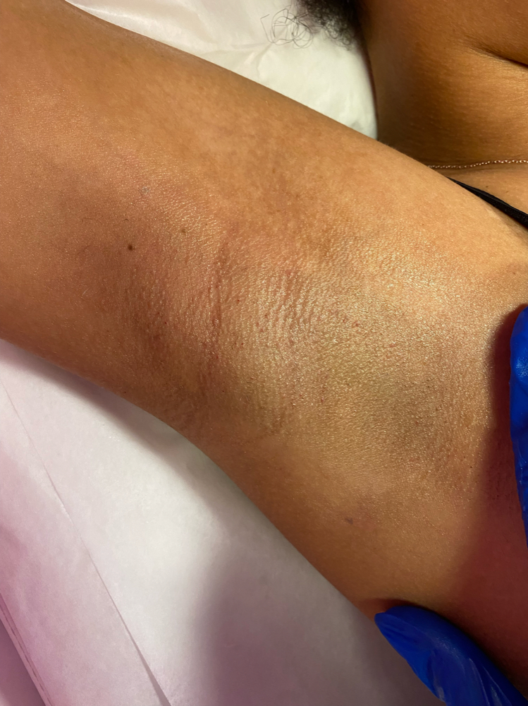 UNDERARM WAX