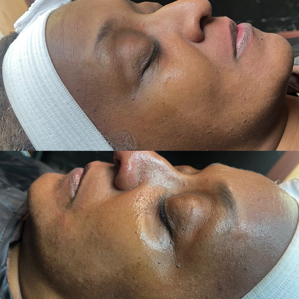 Deep Cleanse Facial