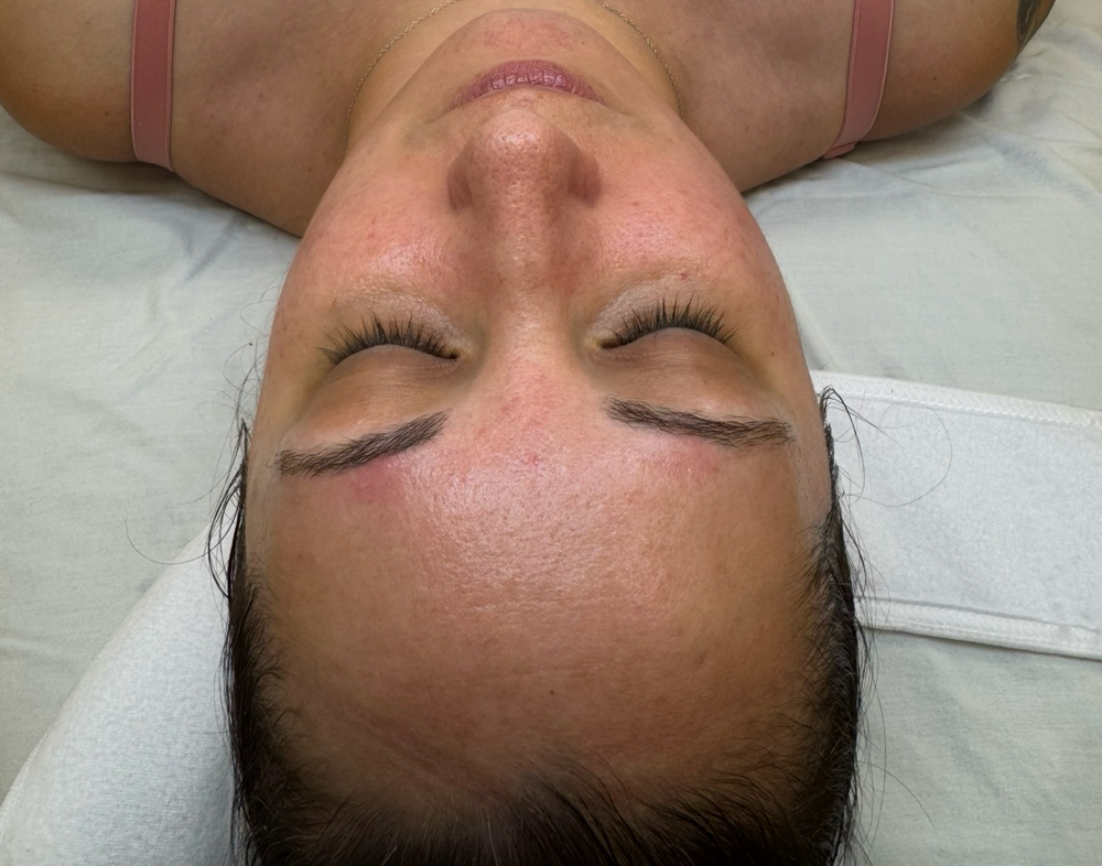 The Fundamental Facial