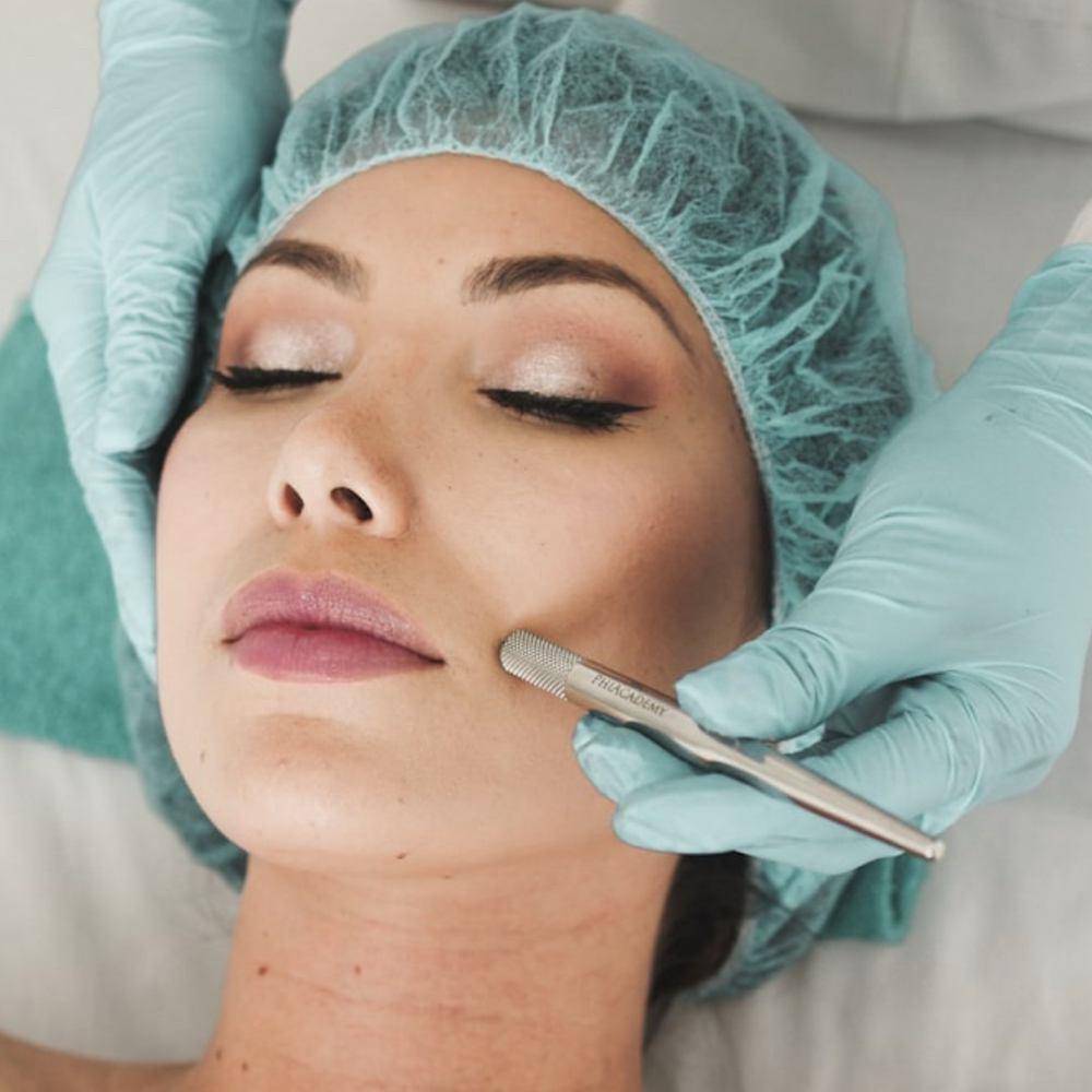 Microdermabrasion at Eula Skin in Dallas, TX