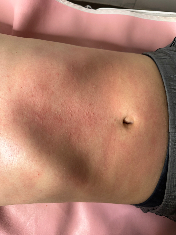 stomach wax