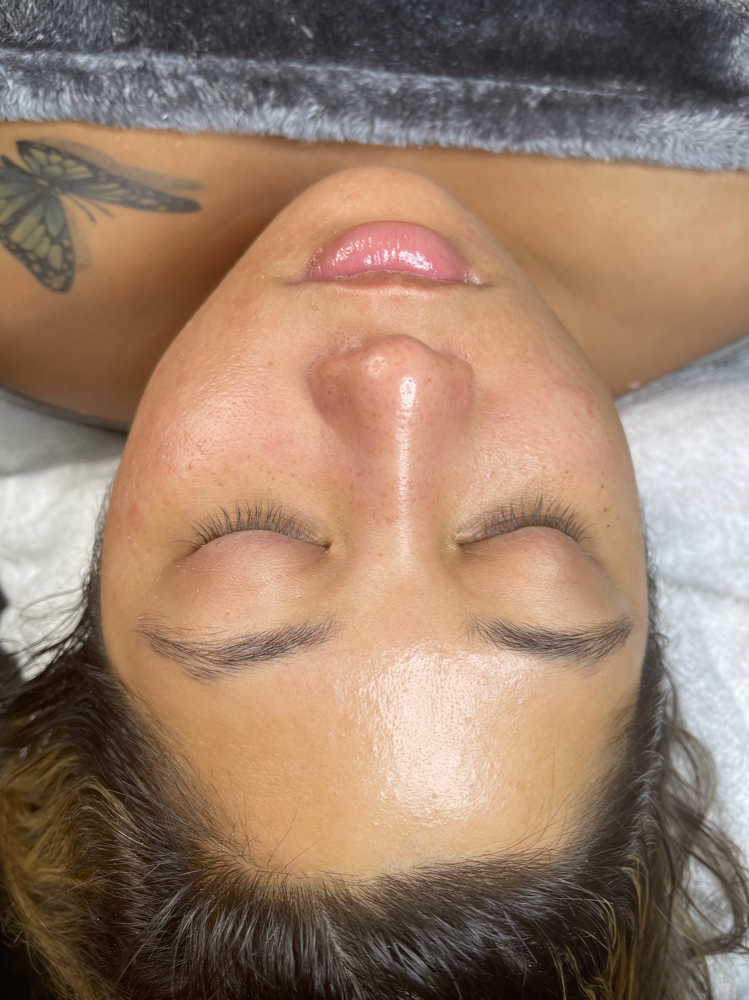 Dermaplaning Facial