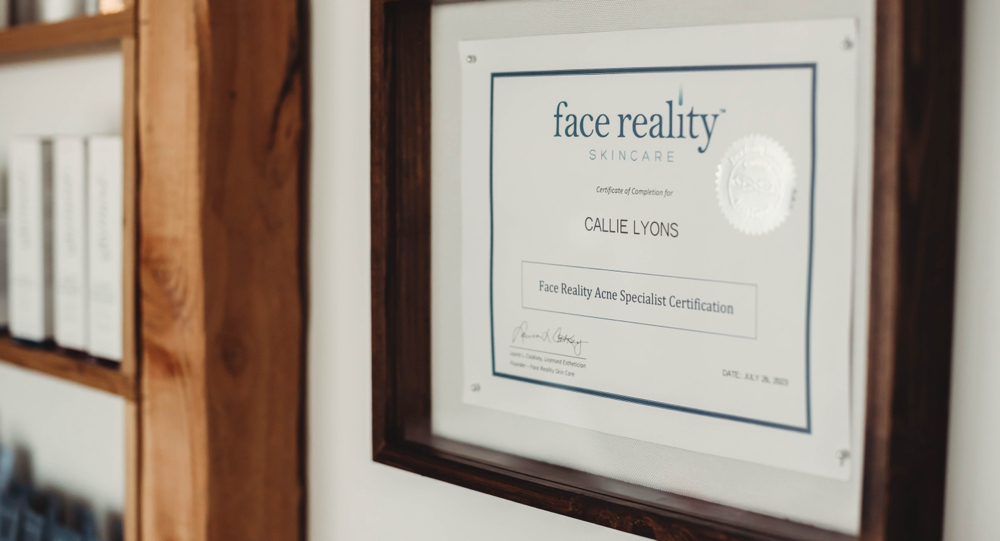 Face Reality Acne Consultation