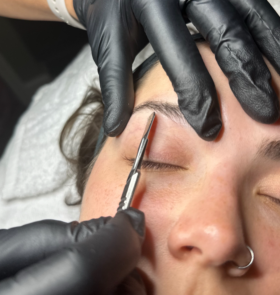 Dermaplaning