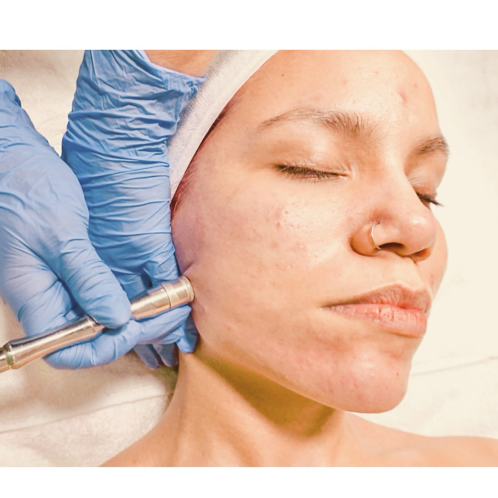 Illustrious Diamond Facial