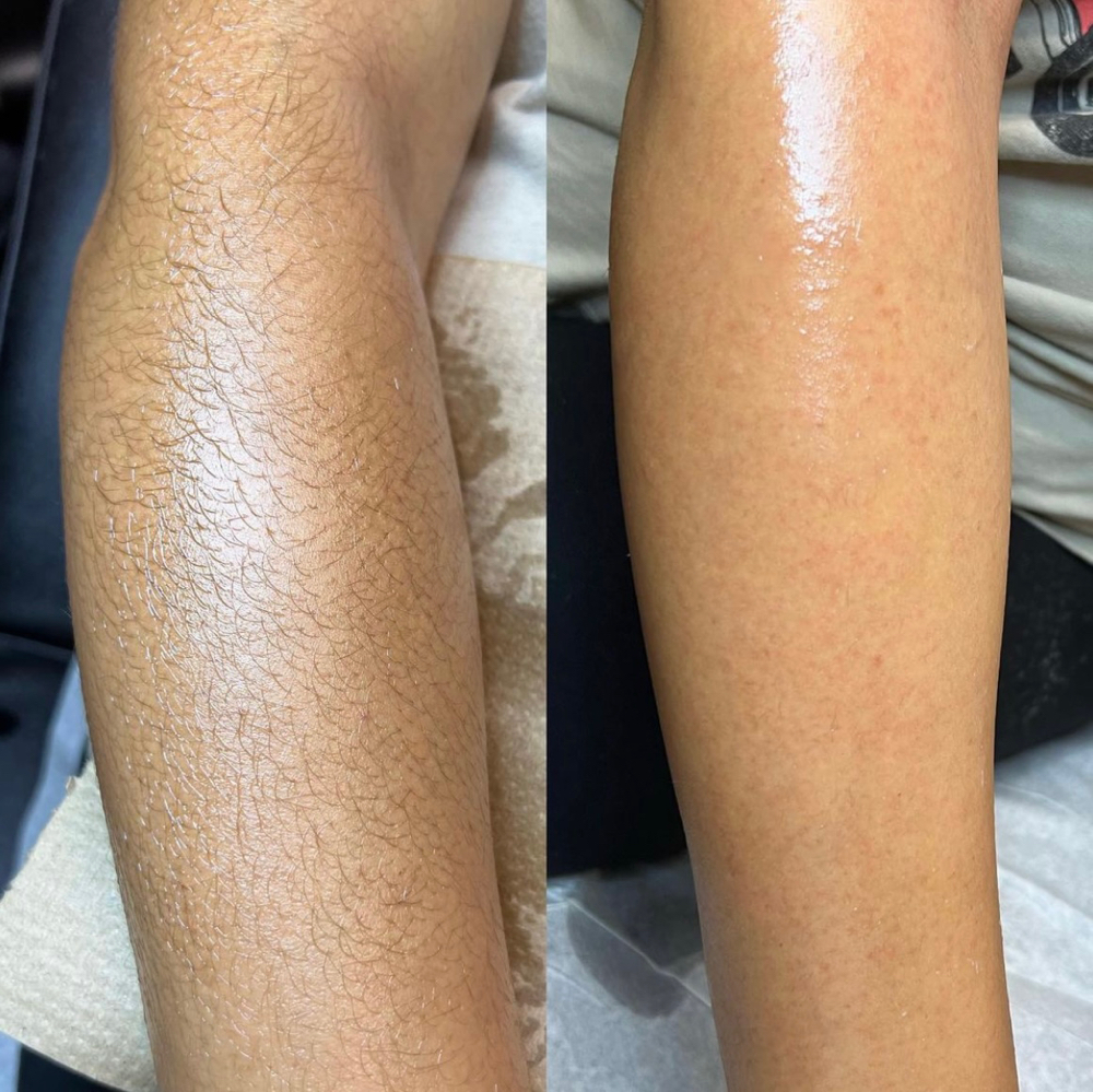 Full Arm Wax