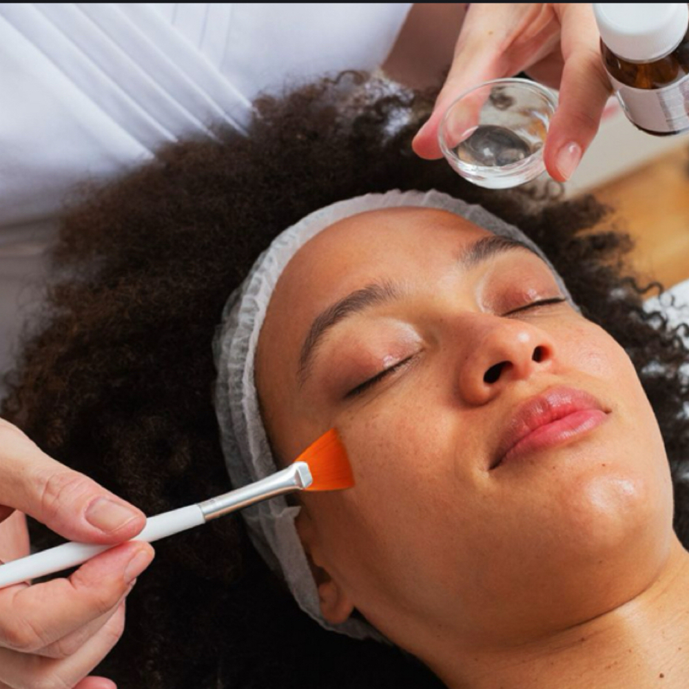 Chemical Peel Series + LED Light at Loba Beauty Spa in Paterson, NJ