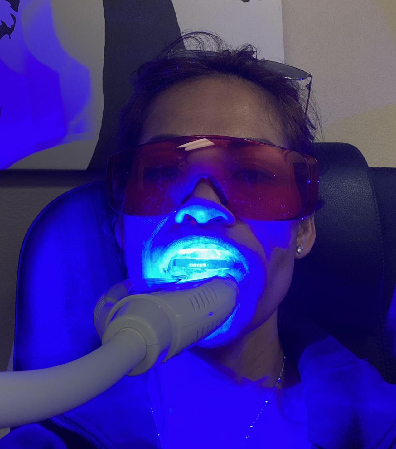 Teeth Whitening