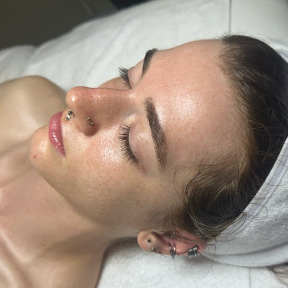 Dermaplane Facial at Altitude Skin Studio in Denver, CO