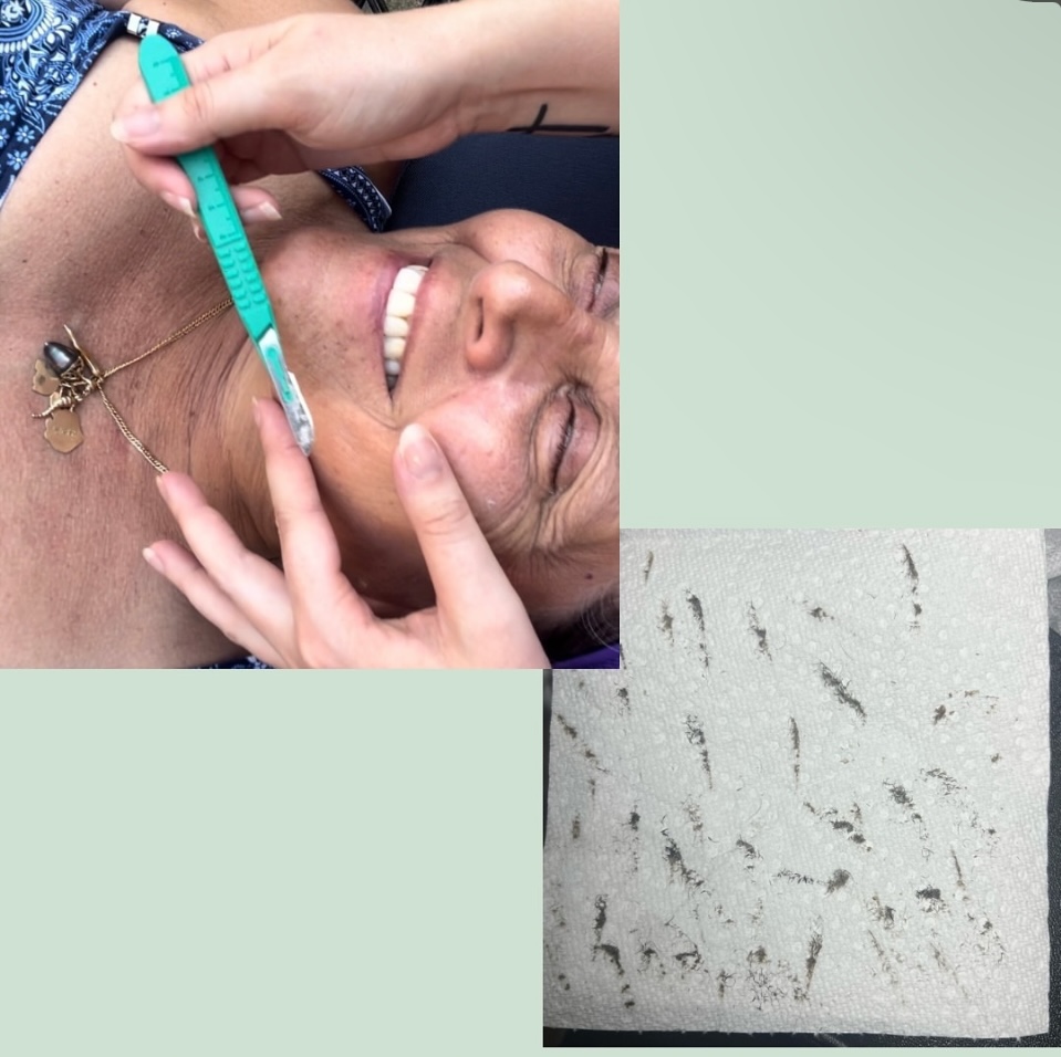 Facial - Dermaplane