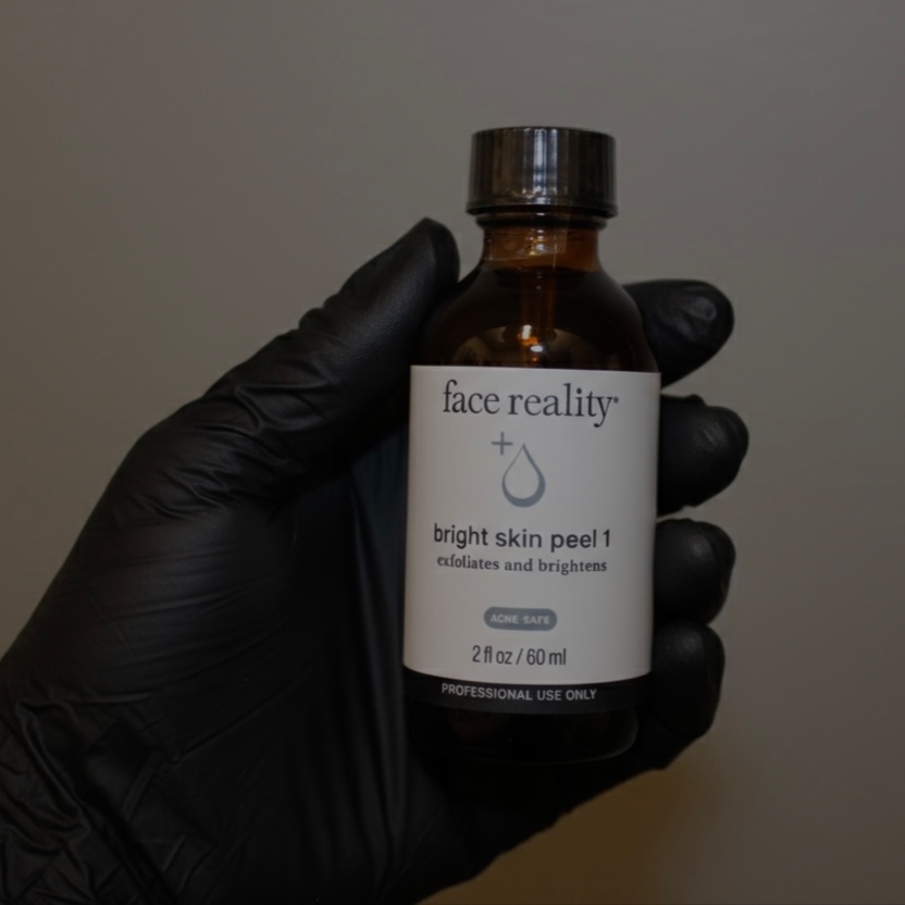 Face Reality Chemical Peel at Glow by Allison in Grapevine, TX