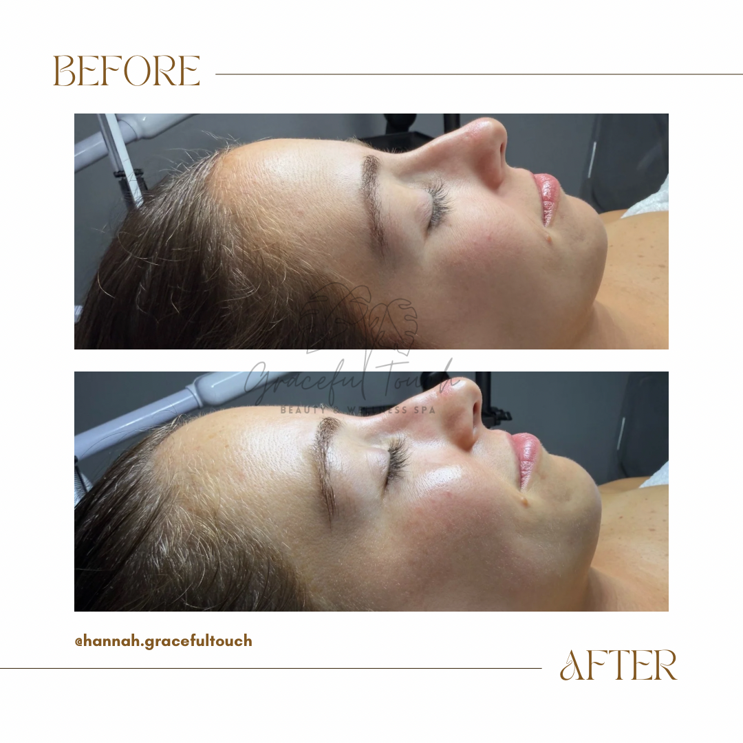 Customized Facial 60 mins