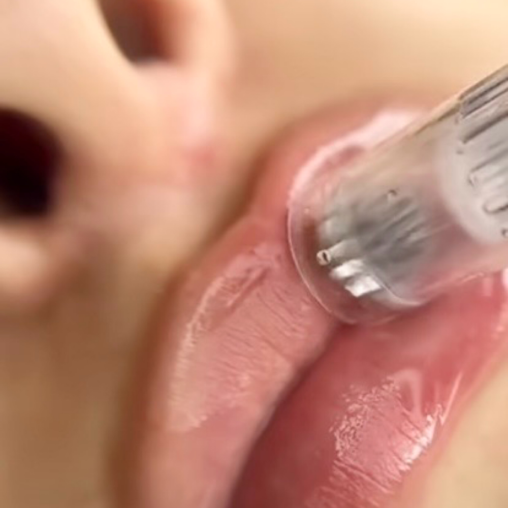 💧 Add-On | Luxe Lip Infusion at Tru U Esthetix in Franklin, TN